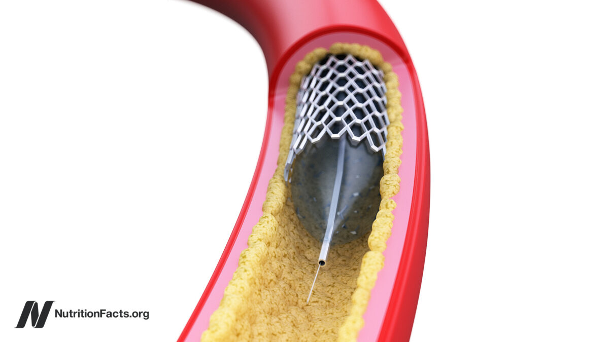 Why are the vascular heart pillars not more effective? star-news.press/wp