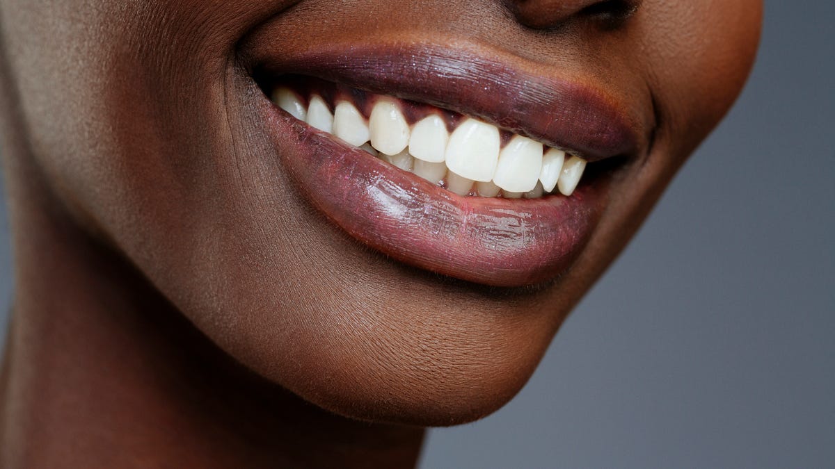 The best bleaching paste for 2025, according to dentists